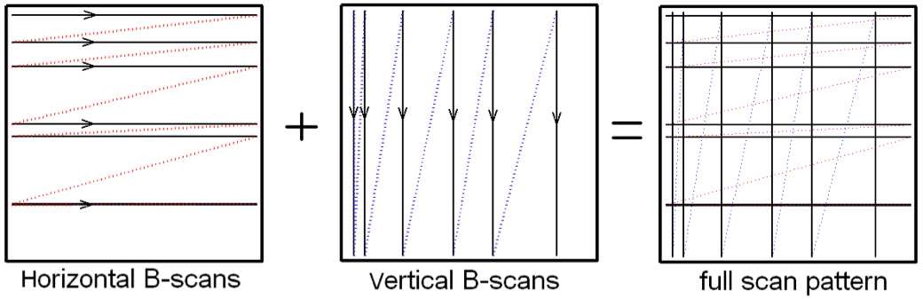 Figure1: Proposed scan pattern consisting of randomly spaced horizontal B-scans and randomly spaced vertical B-scans. The doted lines represent the fly-back trajectory of the galvonometer mirrors