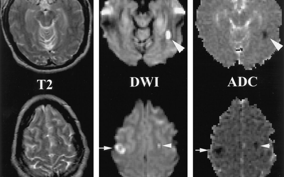 Diffusion Weighted Imaging — MATLAB Number ONE