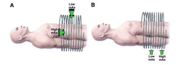 Figure 2: (A) Angular modulation in which the x-ray tube current is lowered as the X-rays