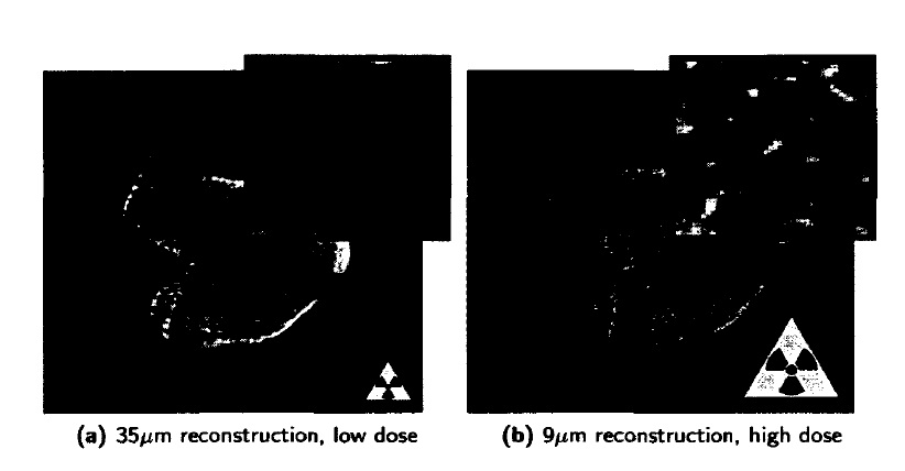 Figure 1: (a) Reconstruction of a polyurethane foam, scanned in a SkyScan 1172 /zCT scanner at a pixel resolution of 17/y.m. (b) Otsu's segmentation of the reconstruction. Many cell walls remain undetected in the segmentation while other structures are overestimated