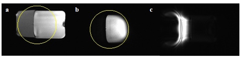 Figure 2 Oil/water phantom imaging experiment. Both water and fat signal are shown in the localizer image (a), only water signal is imaged in the eZOOM image (b) with the circular refocusing area pictured as the overlaid circle, and only the fat portion of the phantom is excited by application of a single 180 degree elliptical refocusing pulse (c).
