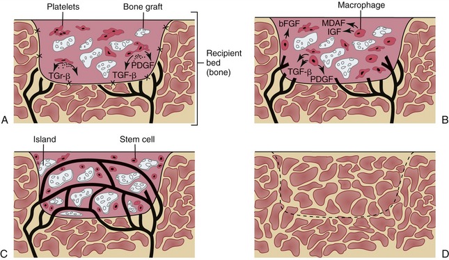 The healing of bone grafts