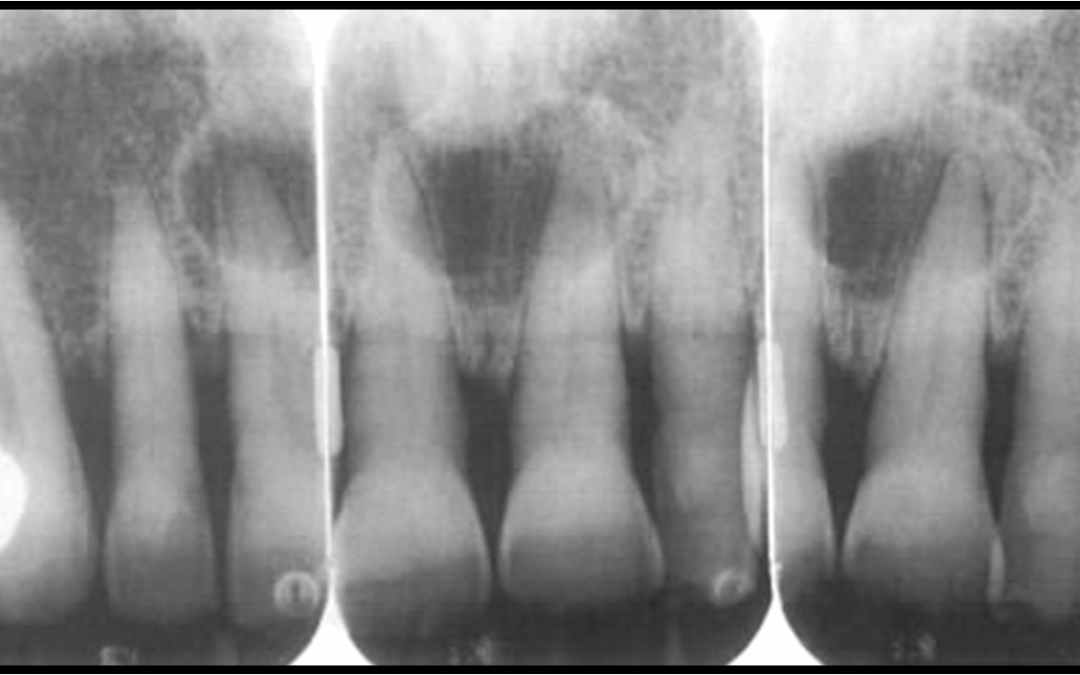 Radiographic Appearance