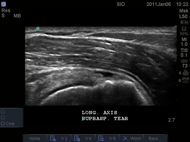 Musculoskeletal Ultrasound