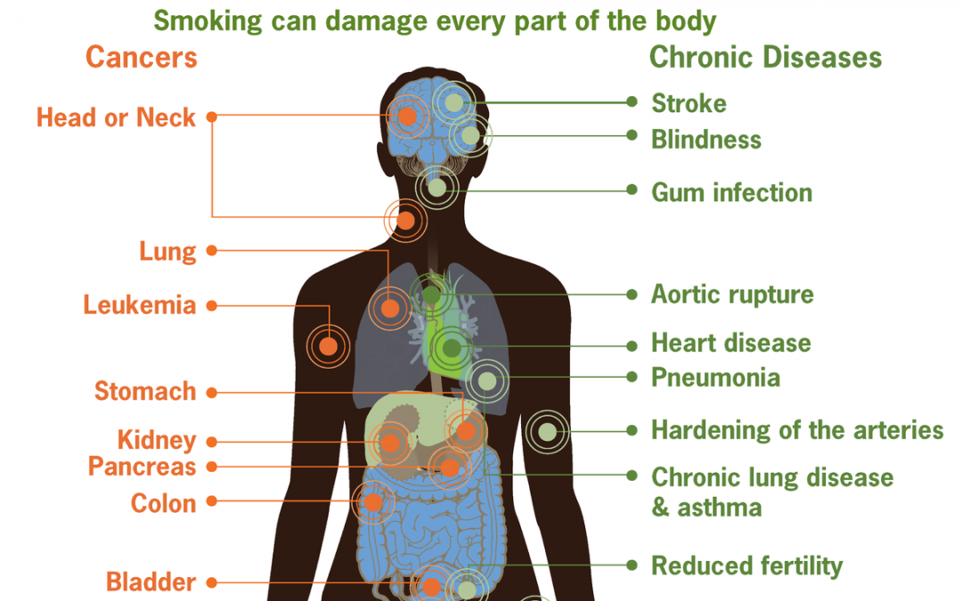 Risks form smoking
