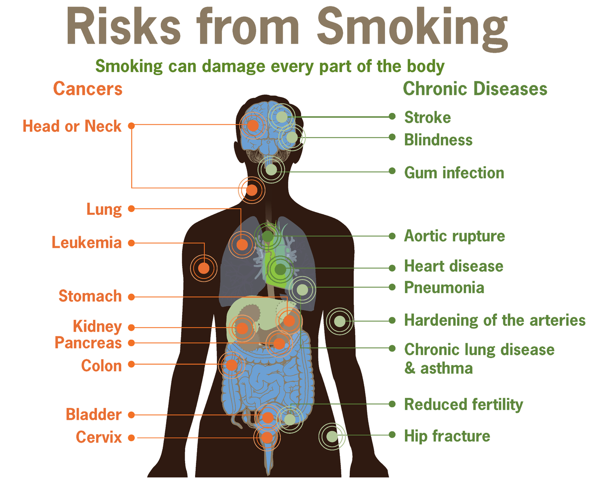 Risks form smoking