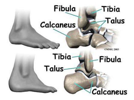 Ankle-Foot Anatomical Bone Structure