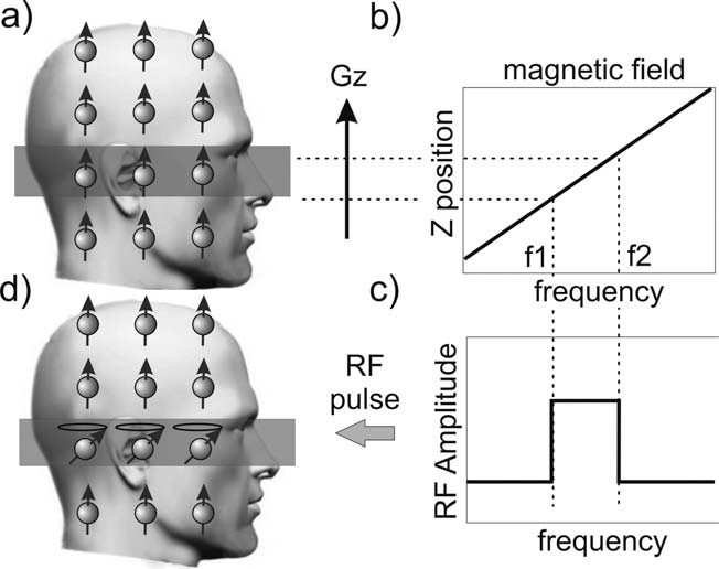 Figure 1. A visual depiction of the slice selection process. The GZ magnetic field gradient induces a linear variation in frequency as a function of position (b). The desired slice location and thickness, ΔZ, then corresponds to a specific frequency bandwidth, ΔF (a, c). By playing out an RF pulse with the same bandwidth only those spins in the desired slice are tipped into the transverse plane (d).