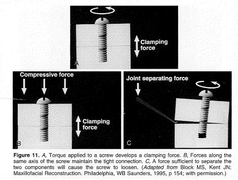 Figure 4. Clamping forces.