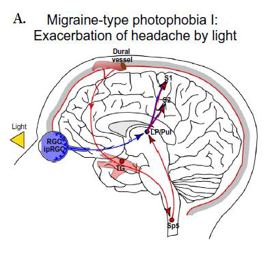 Figure 1. Photophobia Mechanism. Proposed mechanisms for A) exacerbation of headache by light, B) light hypersensitivity in migraineurs, and C) light-induced ocular pain (Noseda & Burstein, 2013).