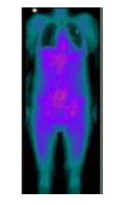 FIGURE 1. Gamma ray imaging [1].