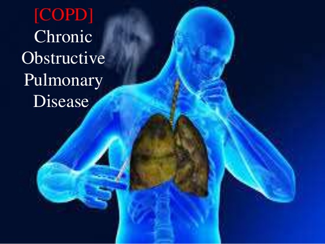 Assocation Between Occupational Exposure To Dusts And Chronic Obstarctive PulmonaryDiseas