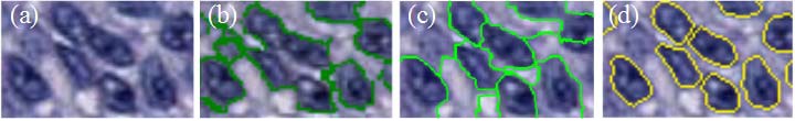 Figure 1. Segmentation results on three methods on arbitrarily choosen patch. From left to right: a. Original image, b. Otsu, c. ISO, d. Minimum-model.