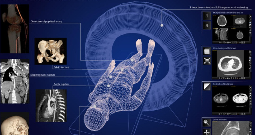 Medical Imaging Overutilization