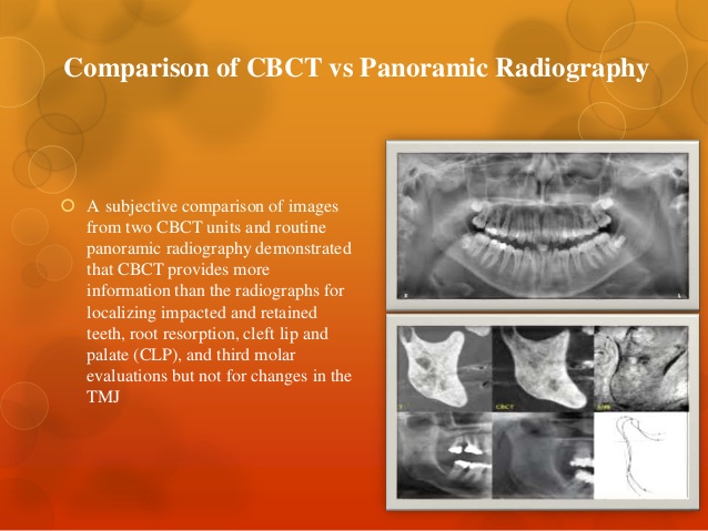 Periapical Radiography vs CBCT