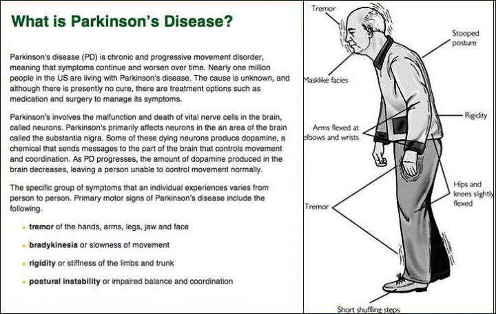 Background Information of Parkinson’s Disease