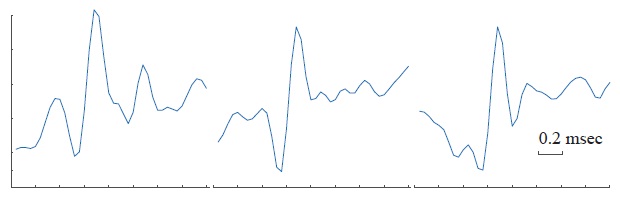 Figure 2.3. Variability of action potential waveforms according to inter-spike intervals. Three different action potentials waveforms lasting 1.6 ms were extracted from the same extracellular recording. The spike waveforms were fired by the same unit at ~16 ms from each other but at different ISIs with respect to the previous spike.