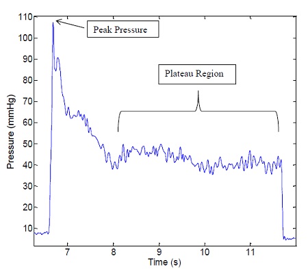 Typical pressure profile indicating peak pressure and plateau region